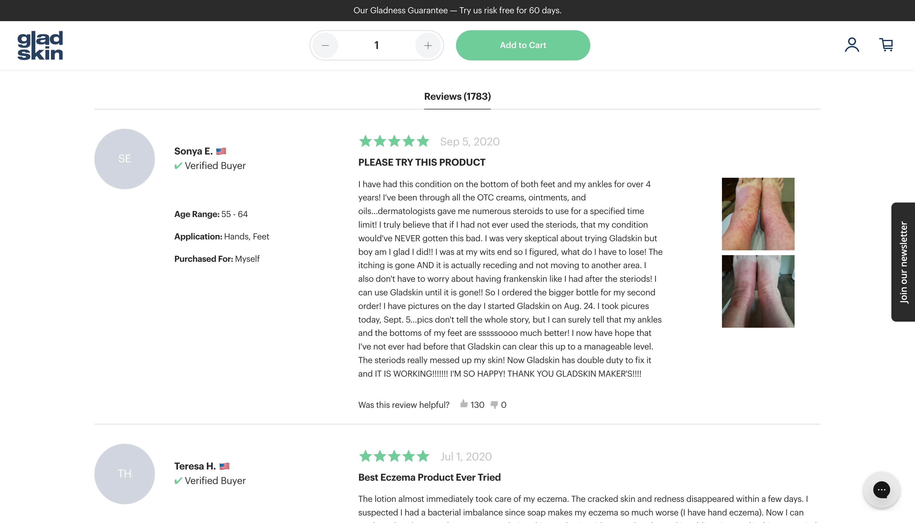 Gladskin - happy customer reviews with photos